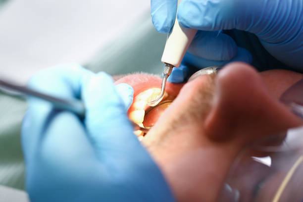 Best Emergency Treatment for Dental Infections or Abscesses in Littleton, CO